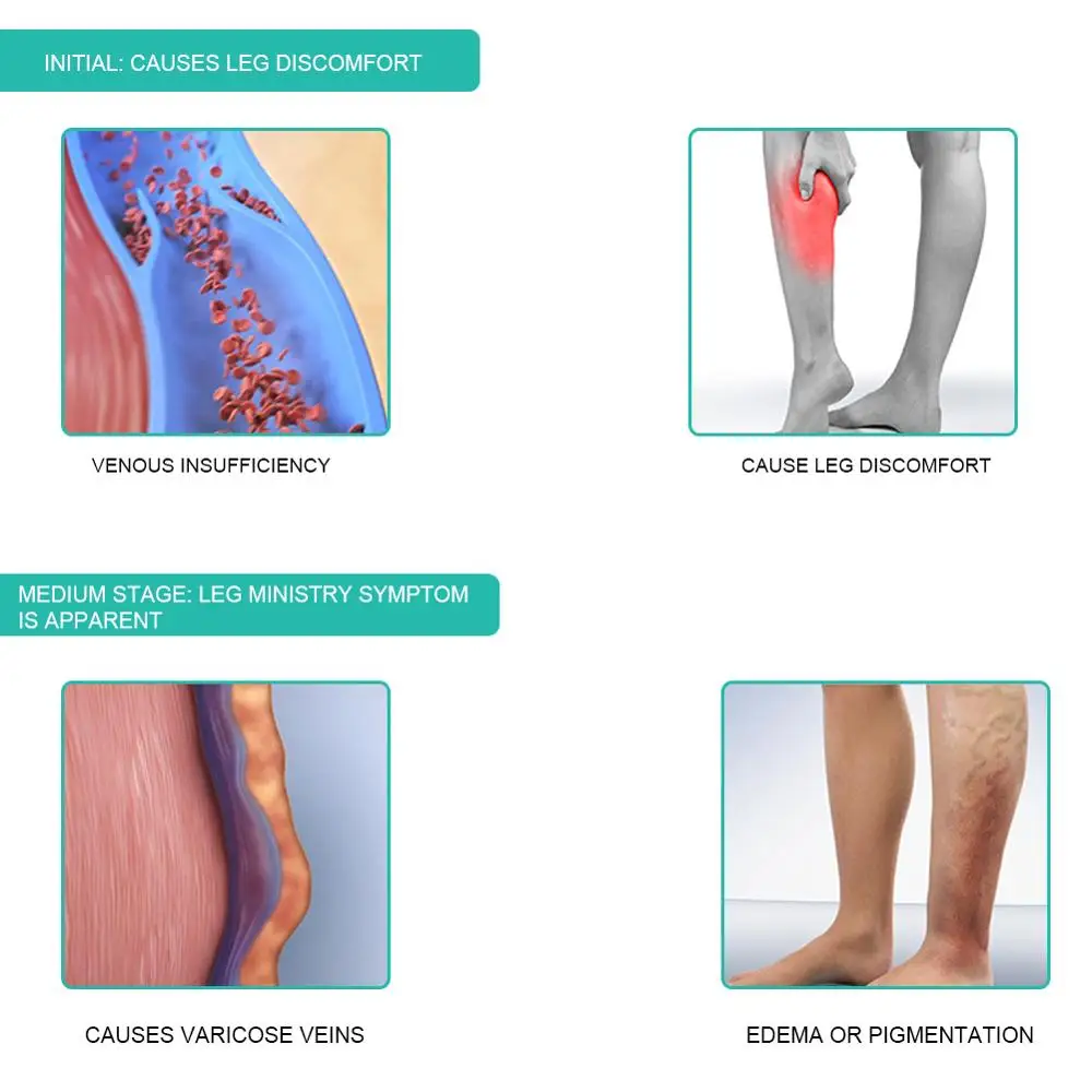 1 para medyczne skarpetki ucis – Compression Sleeve Calf recenzja i cena
